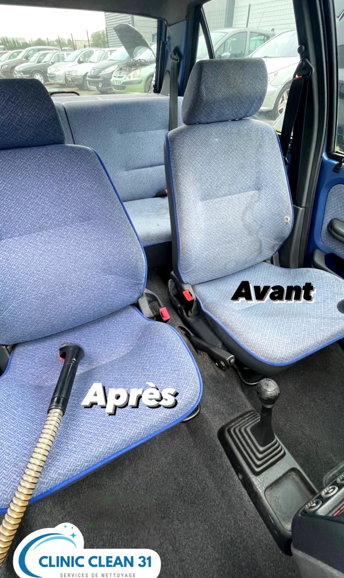 Avant/Après